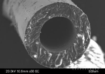 SEM image of hollow fibre membrane cross section
